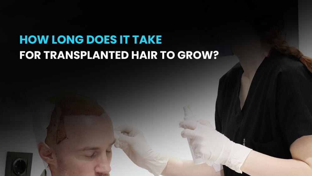 How Long Does It Take for Transplanted Hair to Grow