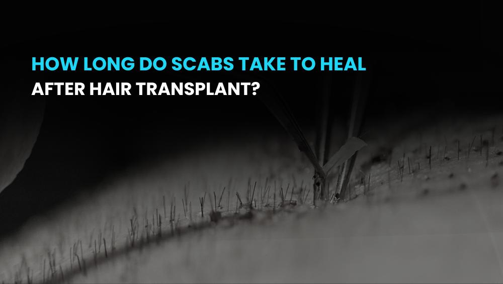 How long do scabs take to heal after hair transplant