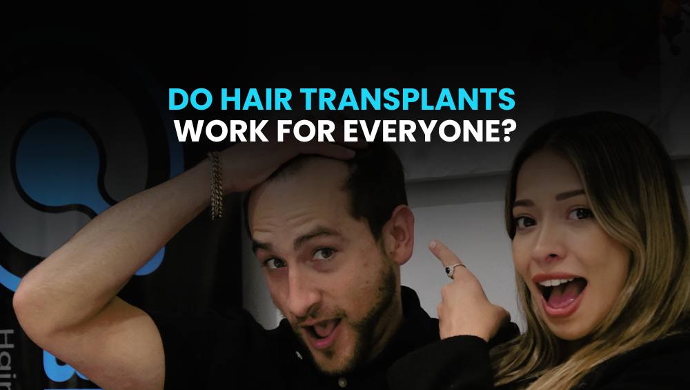 Do hair transplants work for everyone