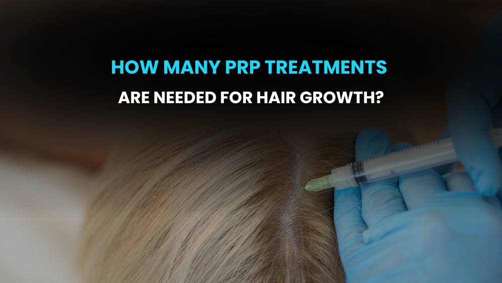 How Many PRP Treatments Are Needed For Hair Growth