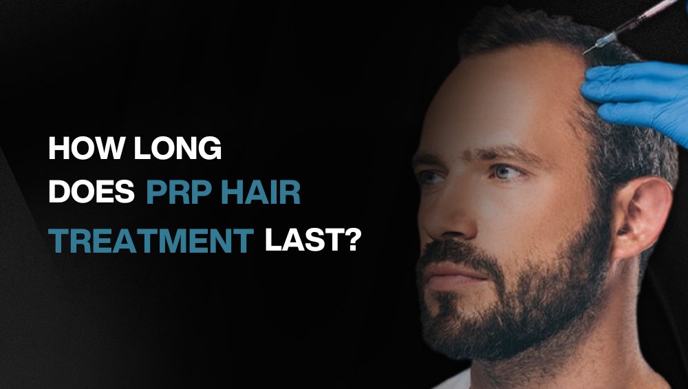 How Long Does PRP Hair Treatment Last