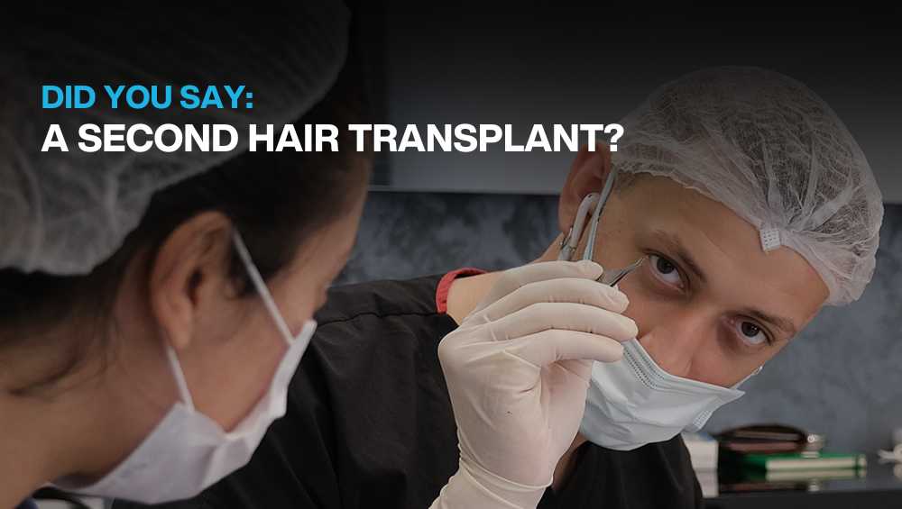 Copy of Hair transplant for Women 2