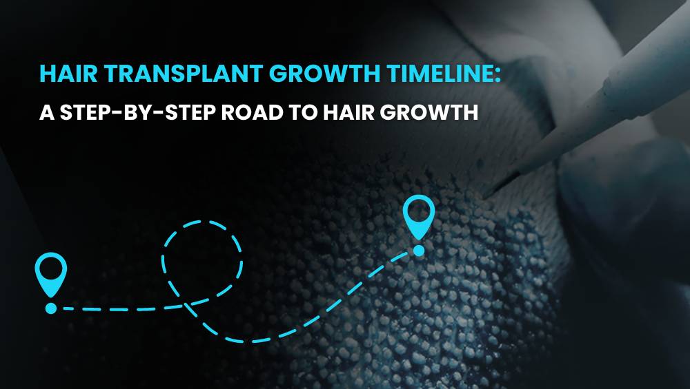 Hair Transplant Growth Timeline