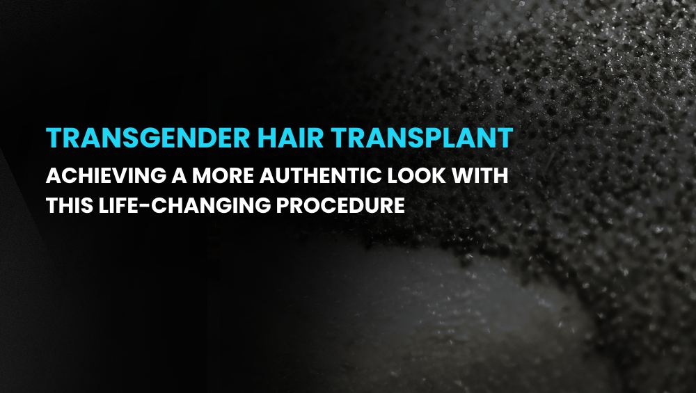 Transgender hair transplant