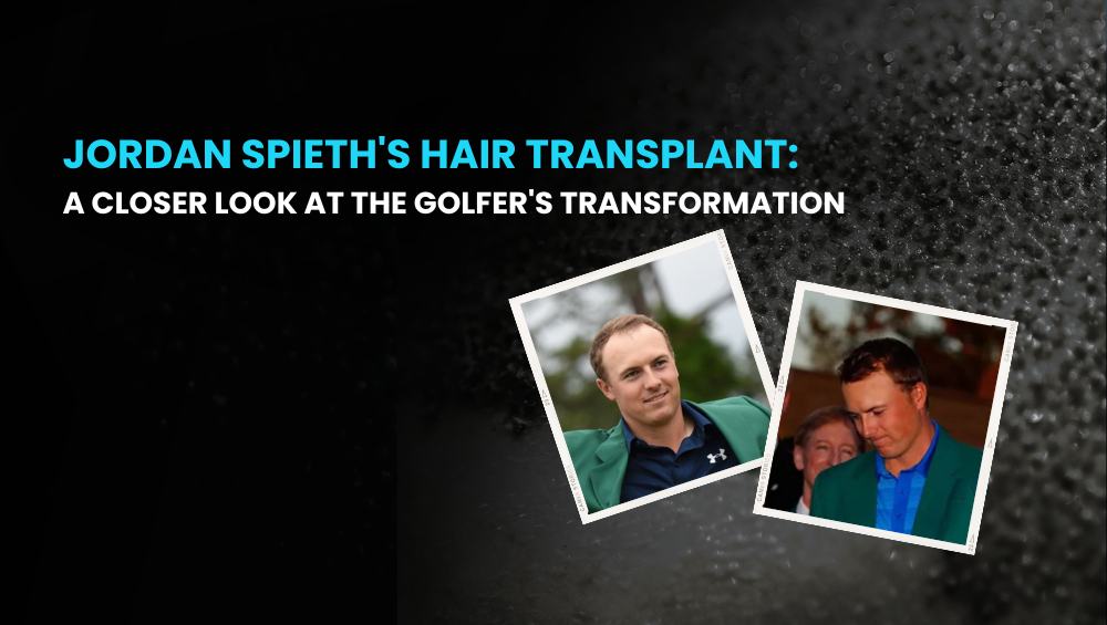 Jordan Spieth Hair Transplant 1