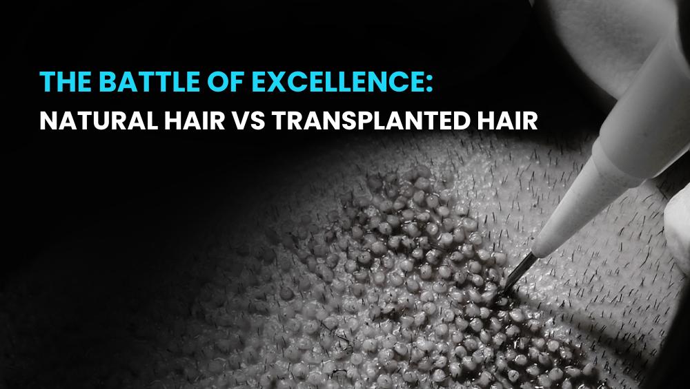 Natural Hair vs Transplanted Hair
