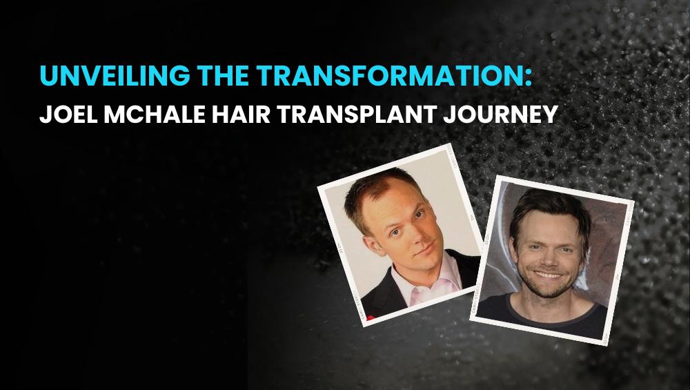 Joel McHale Hair Transplant Journey