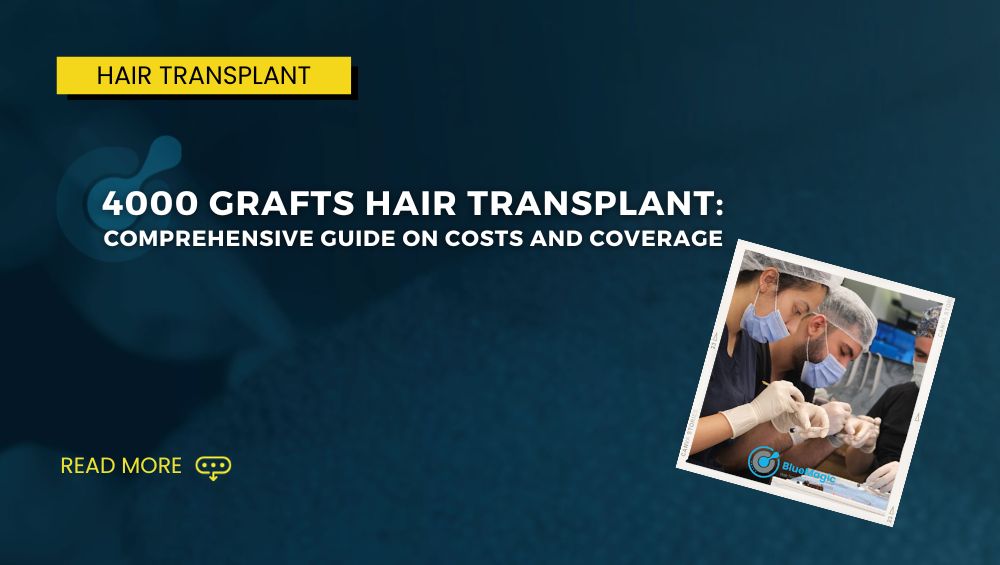 4000 Grafts Hair Transplant