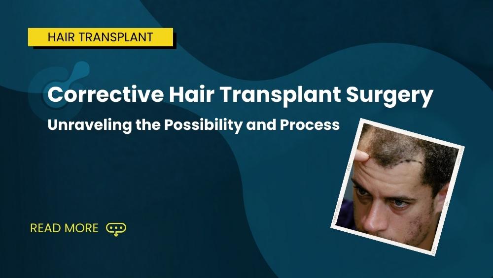 Corrective Hair Transplant Surgery Unraveling the Possibility and Process