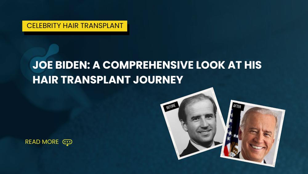 Joe Biden A Comprehensive Look at His Hair Transplant Journey