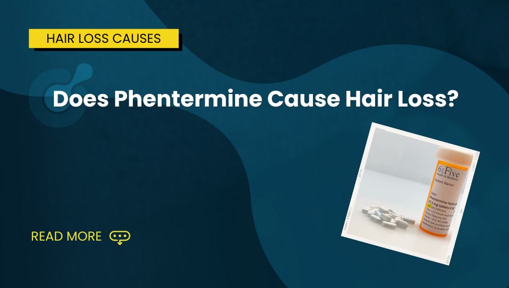 Does Phentermine Cause Hair Loss