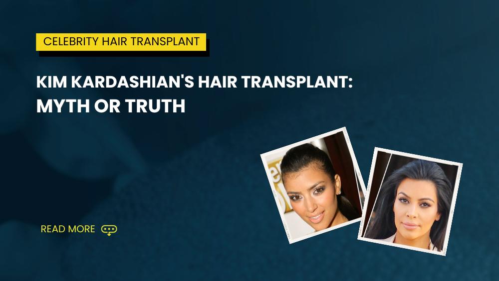 Kim Kardashians Hair Transplant