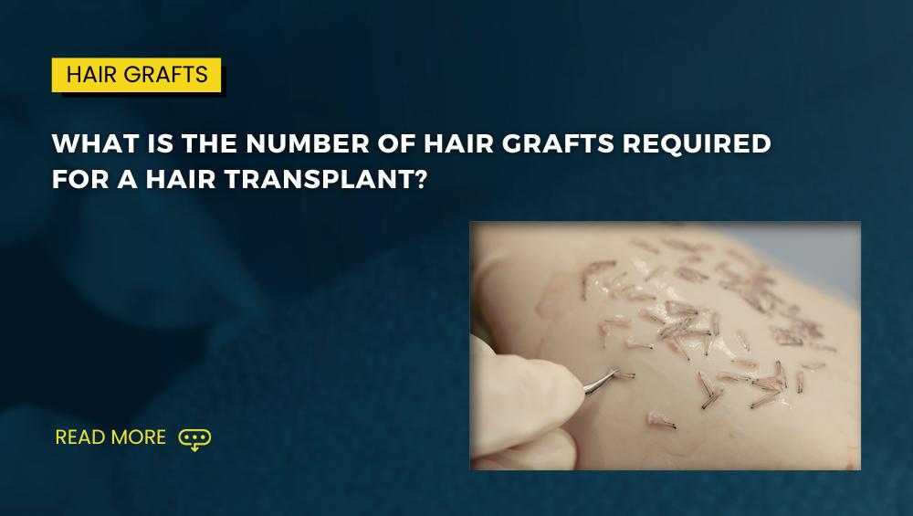 What is the number of hair grafts required for a hair transplant 1
