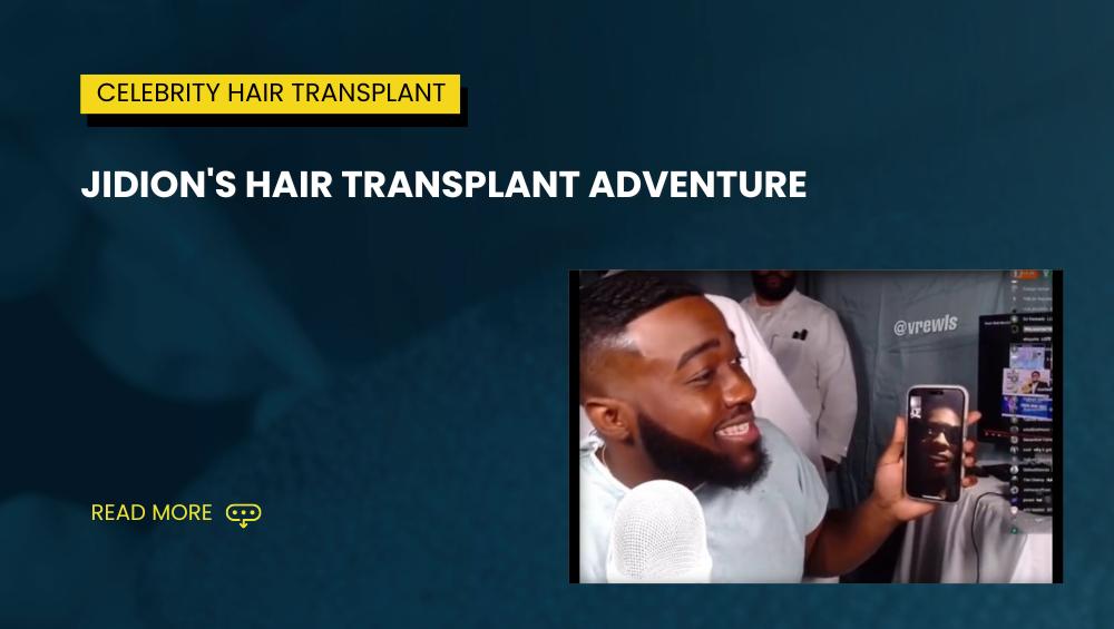 Jidions Hair Transplant Adventure