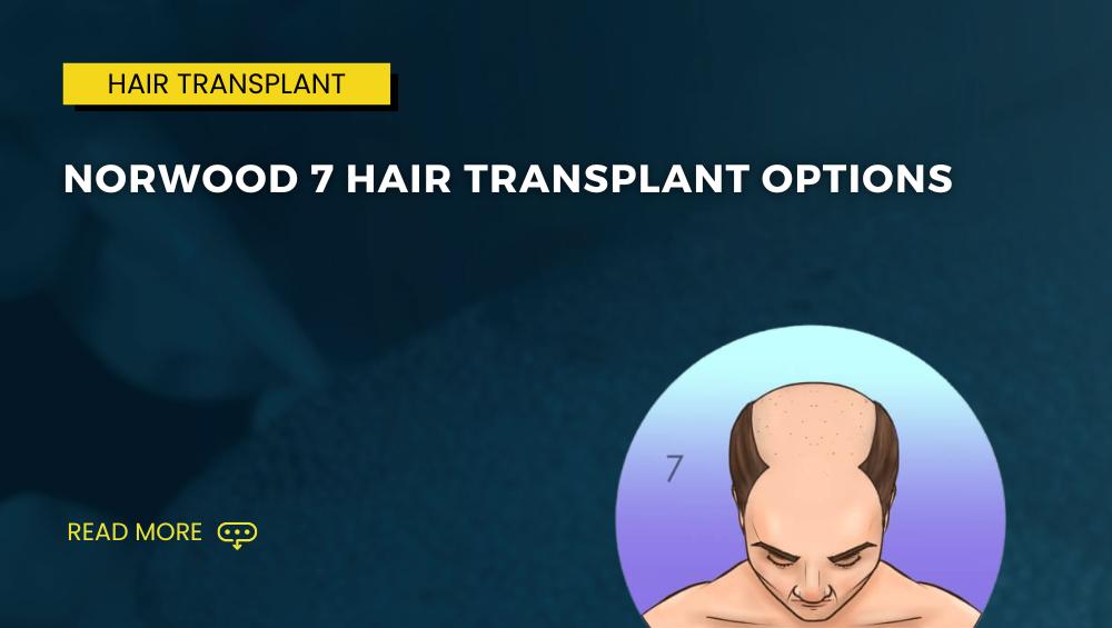 Norwood 7 Hair Transplant Options