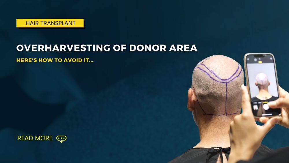 Overharvesting of Donor Area