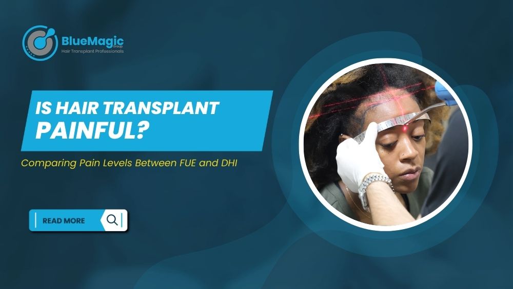 Is Hair Transplant Painful Comparing Pain Levels Between FUE and DHI