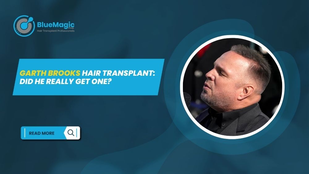 Garth Brooks Hair Transplant Did He Really Get One
