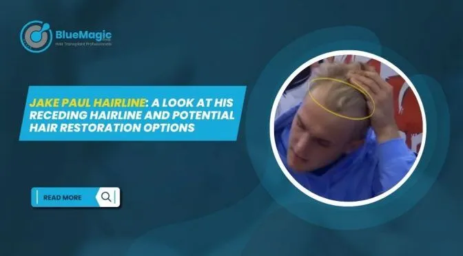 Jake Paul Hairline A Look at His Receding Hairline and Potential Hair Restoration Options