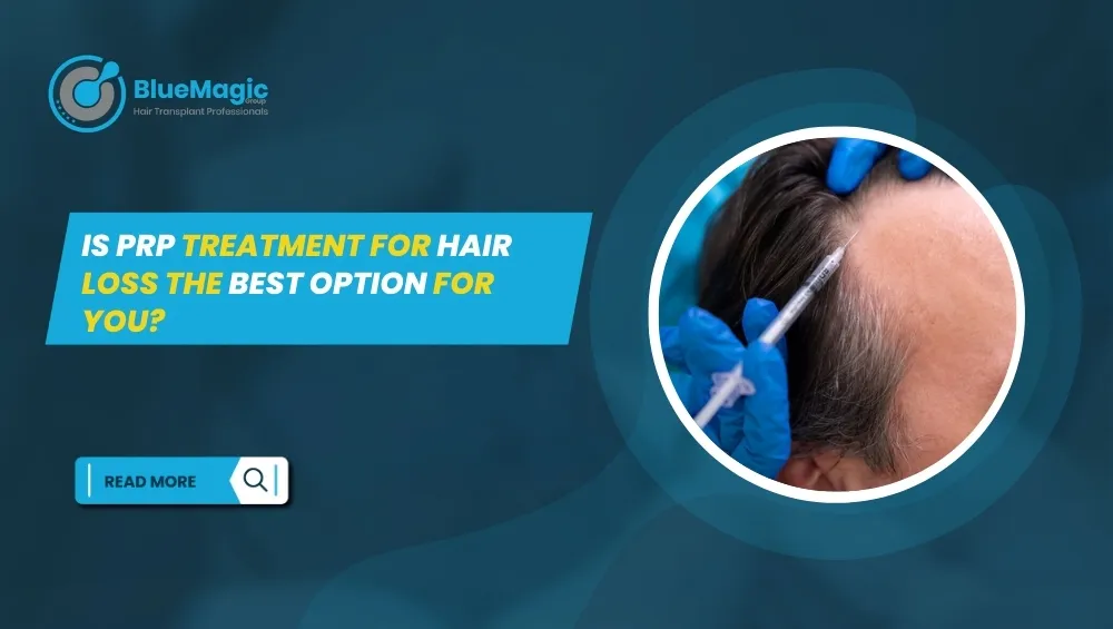 PRP for hair loss treatment