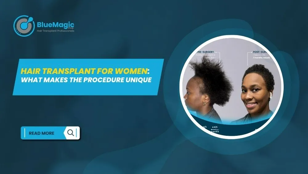 Hair Transplant for Women: What Makes the Procedure Unique