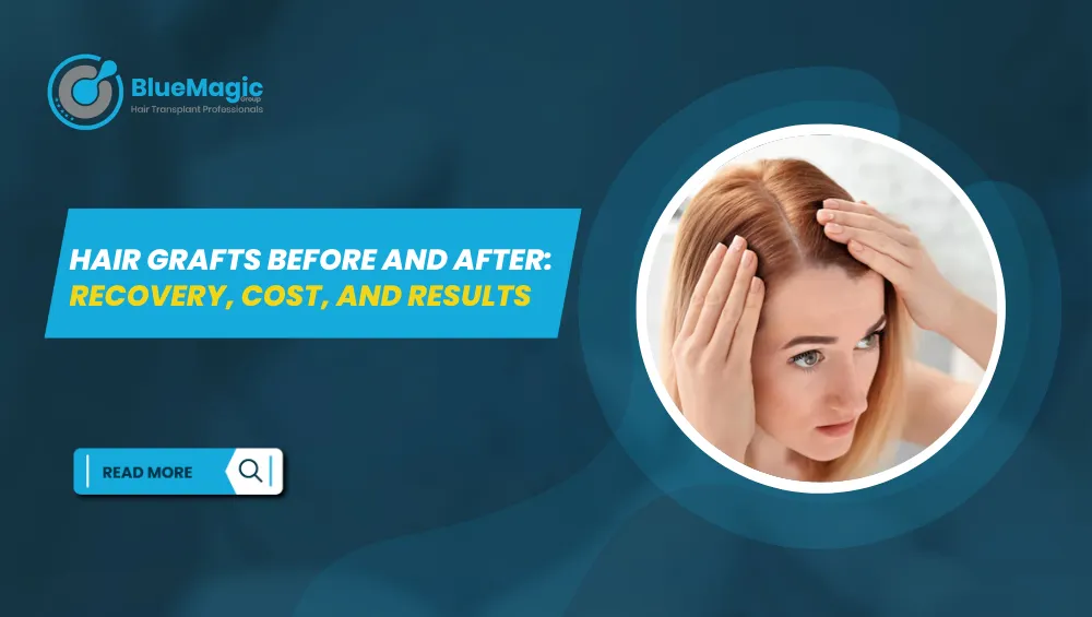 Hair graft recovery