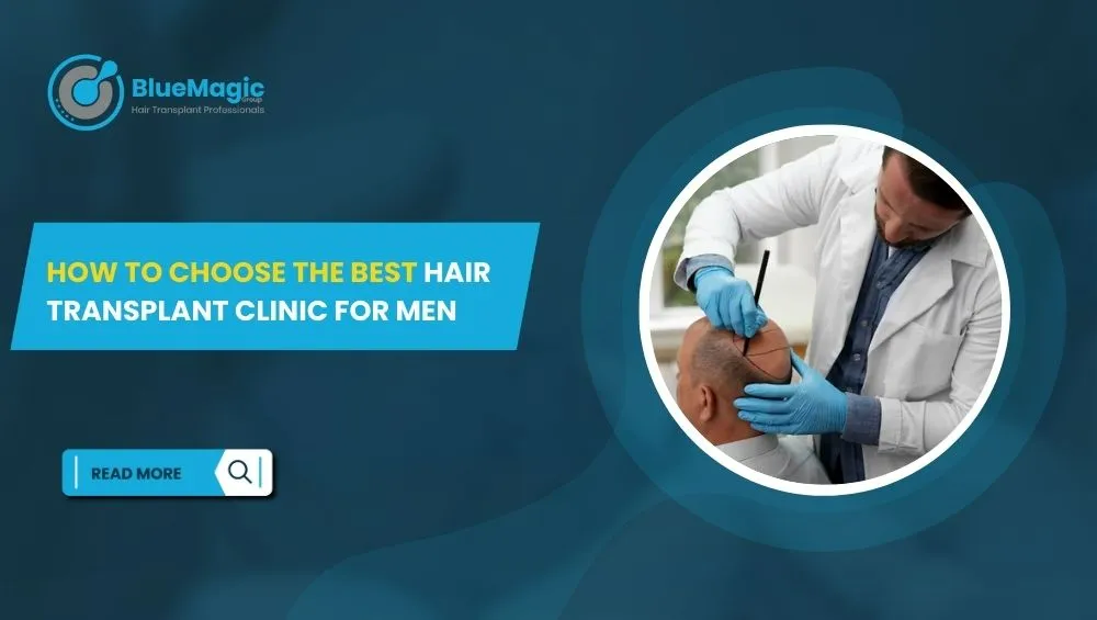 How to Choose the Best Hair Transplant Clinic for Men
