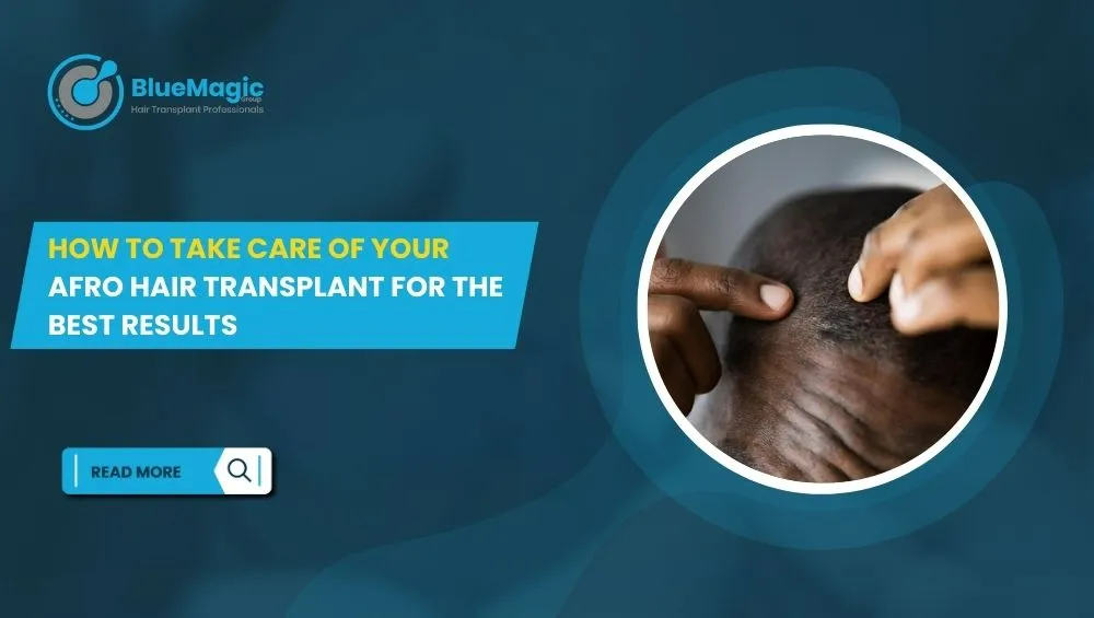 How to Take Care of Your Afro Hair Transplant for the Best Results