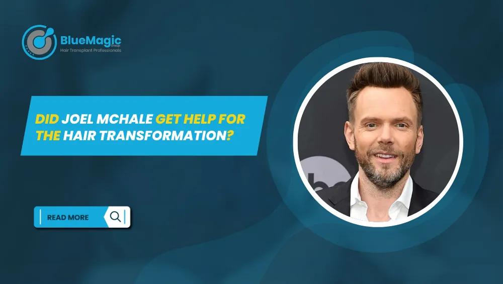 Joel McHale hairline