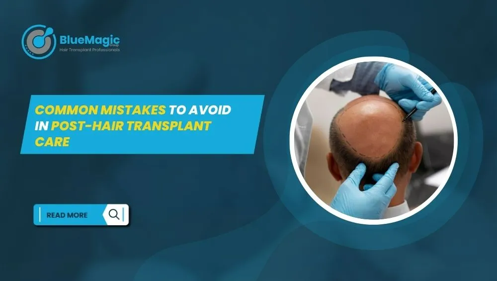 Post-Hair Transplant Care
