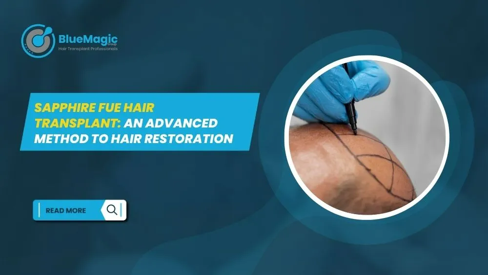 Sapphire FUE hair transplant
