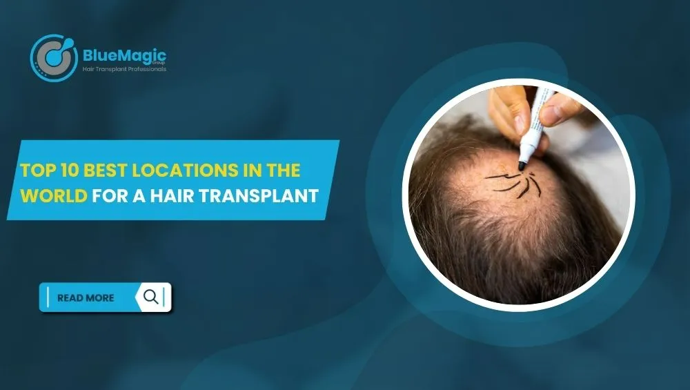 Hair Transplant