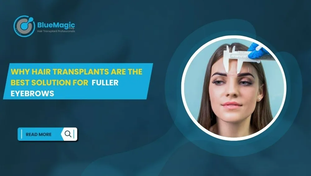 Why Hair Transplants Are the Best Solution for Fuller Eyebrows
