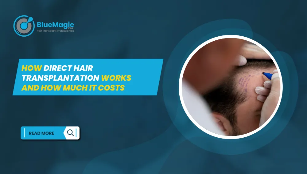 BlueMagic Clinic banner explaining direct hair transplantation, featuring a close-up of the procedure and text 'How Direct Hair Transplantation Works and How Much It Costs.
