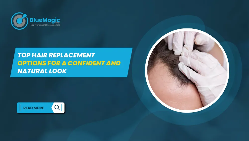BlueMagic Clinic banner featuring a hair replacement procedure with the text 'Top Hair Replacement Options for a Confident and Natural Look.