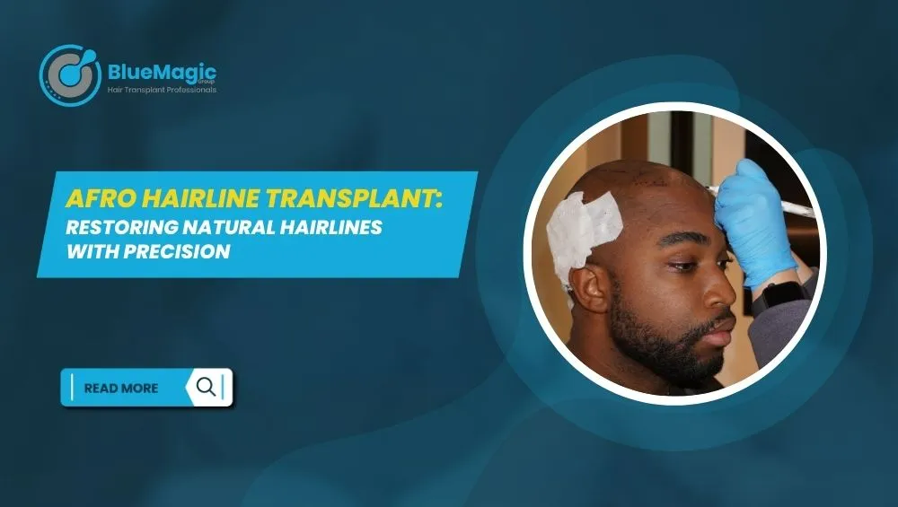 Afro Hairline Transplant Restoring Natural Hairlines with Precision