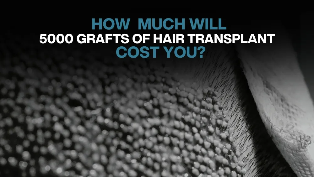 Copy of Hair transplant for Women 20
