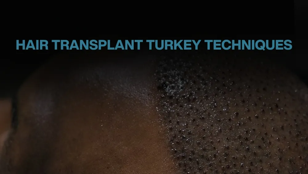 Copy of Hair transplant for Women 32