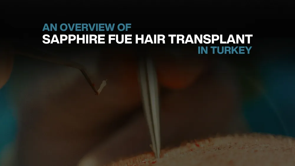 Copy of Hair transplant for Women 6