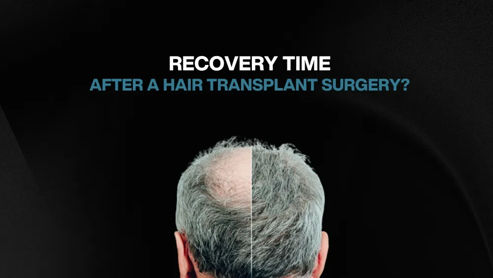 Copy of Hair transplant for Women 8