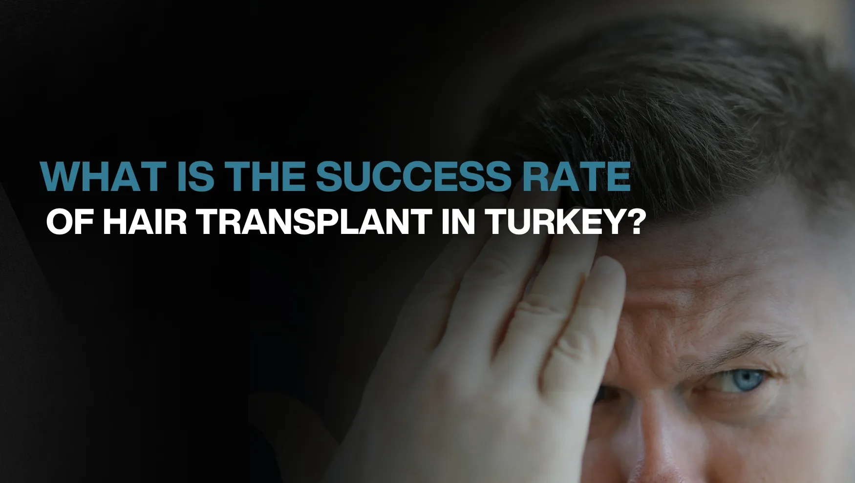 Copy of Hair transplant for Women