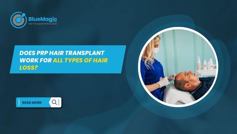 PRP Hair Transplant