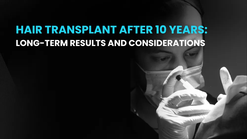 Hair Transplant After 10 Years