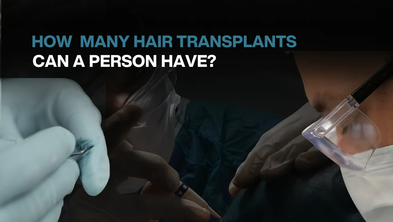 Hair transplant f multiple sessions