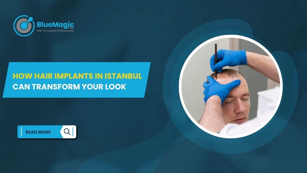 How Hair Implants in Istanbul Can Transform Your Look