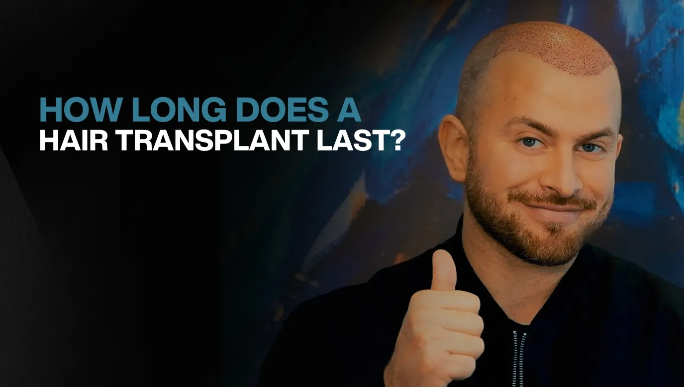 How long does a hair transplant last 1