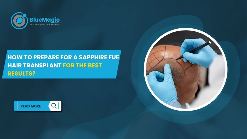 How to Prepare for a Sapphire FUE Hair Transplant for the Best Results