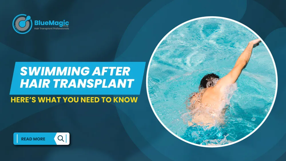Swimming after hair transplant