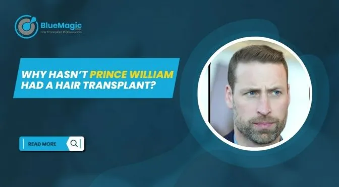 Why Hasnt Prince William Had a Hair Transplant 672x372 1