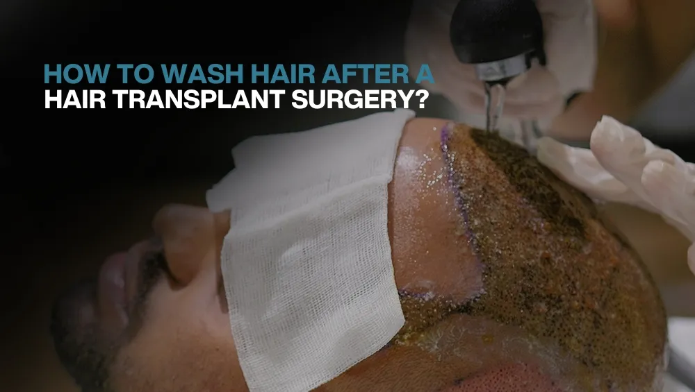 hair wash after surgery